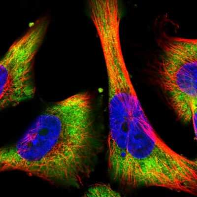 Immunocytochemistry/ Immunofluorescence: BTF3 Antibody [NBP2-49225]