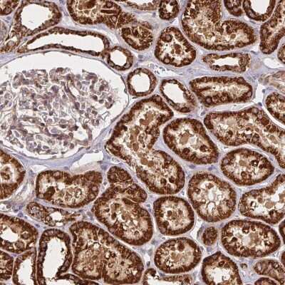 Immunohistochemistry-Paraffin: BTF3 Antibody [NBP2-49225]