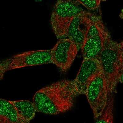 Immunocytochemistry/ Immunofluorescence: BTF3L4 Antibody [NBP2-38097]