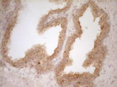Immunohistochemistry: BTG1 Antibody (OTI7H6) [NBP2-46586]