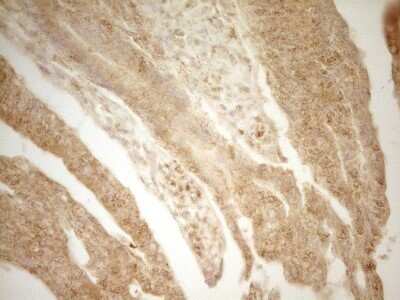 Immunohistochemistry: BTG1 Antibody (OTI7H6) - Azide and BSA Free [NBP2-70286]