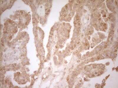 Immunohistochemistry: BTG1 Antibody (OTI7H6) - Azide and BSA Free [NBP2-70286]