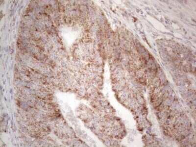 Immunohistochemistry: BTG2 Antibody (OTI4C10) - Azide and BSA Free [NBP2-71339]