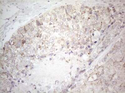 Immunohistochemistry: BTG2 Antibody (OTI4C10) - Azide and BSA Free [NBP2-71339]