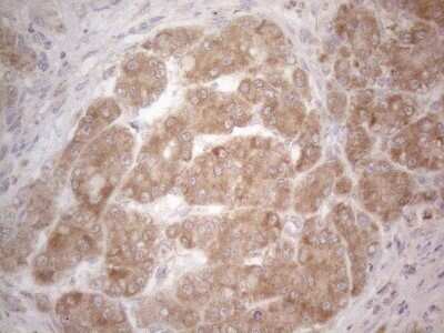 Immunohistochemistry: BTG2 Antibody (OTI4C10) - Azide and BSA Free [NBP2-71339]