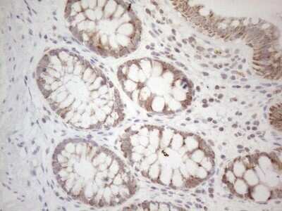 Immunohistochemistry: BTG2 Antibody (OTI4C10) - Azide and BSA Free [NBP2-71339]