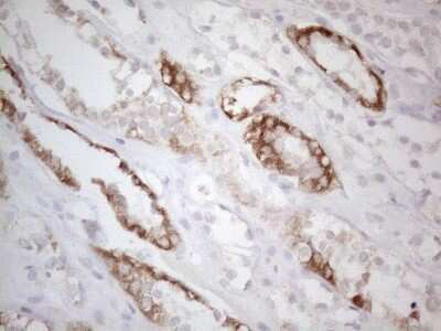 Immunohistochemistry: BTG2 Antibody (OTI4C10) - Azide and BSA Free [NBP2-71339]