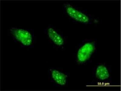 Immunocytochemistry/ Immunofluorescence: BTG4 Antibody (1A6) [H00054766-M07]