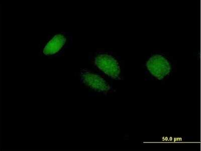Immunocytochemistry/ Immunofluorescence: BTG4 Antibody [H00054766-B01P]