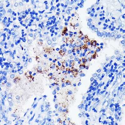 Immunohistochemistry-Paraffin: BTK Antibody (2J9O8) [NBP3-15612]