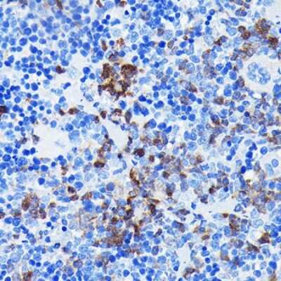 Immunohistochemistry-Paraffin: BTK Antibody (2J9O8) [NBP3-15612]