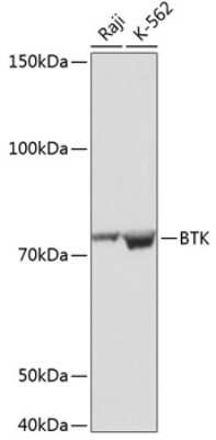 Western Blot: BTK Antibody (2J9O8) [NBP3-15612]