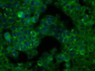 Immunocytochemistry/ Immunofluorescence: BTK Antibody (OTI3A2) [NBP2-02472]
