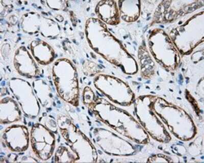 Immunohistochemistry-Paraffin: BTK Antibody (OTI3A2) [NBP2-02472]