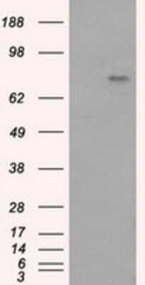 Western Blot: BTK Antibody (OTI3A2) [NBP2-02472]