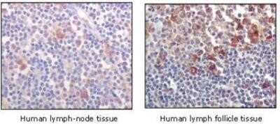 Immunohistochemistry-Paraffin: BTK Antibody (7F12H4) - Azide and BSA Free [NBP2-80605]