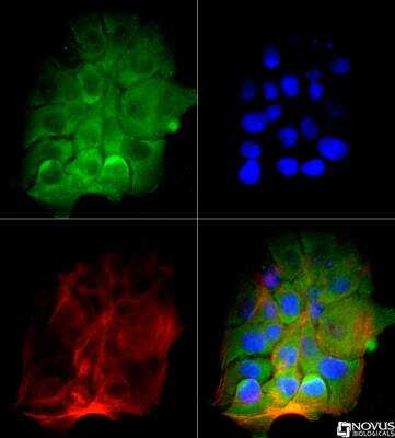 Immunocytochemistry/ Immunofluorescence: BTK Antibody (7F12H4) - BSA Free [NB110-87047]