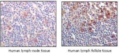 Immunohistochemistry-Paraffin: BTK Antibody (7F12H4) - BSA Free [NB110-87047]