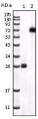 Western Blot: BTK Antibody (7F12H4)BSA Free [NB110-87047]