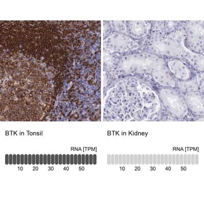 Immunohistochemistry-Paraffin: BTK Antibody [NBP1-89207]