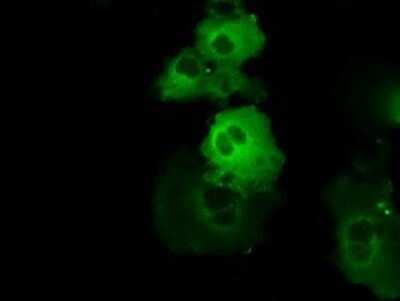 Immunocytochemistry/ Immunofluorescence: BTK Antibody (OTI3A2) - Azide and BSA Free [NBP2-70291]