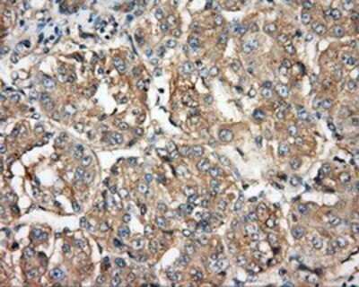 Immunohistochemistry: BTK Antibody (OTI3A2) - Azide and BSA Free [NBP2-70291]