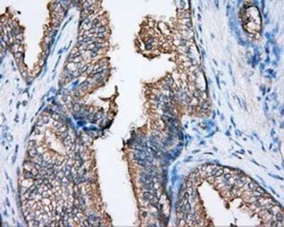 Immunohistochemistry: BTK Antibody (OTI3A2) - Azide and BSA Free [NBP2-70291]