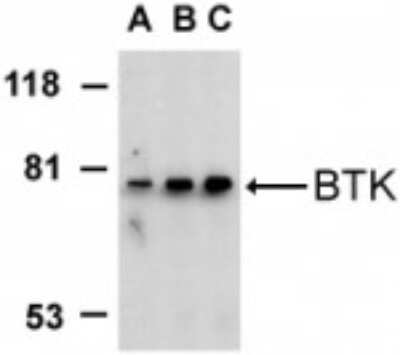 Western Blot: BTK AntibodyBSA Free [NBP1-76596]