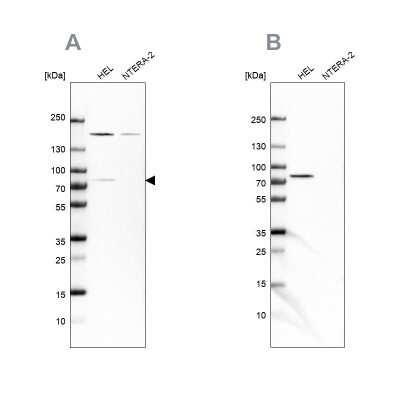 Western Blot: BTK Antibody [NBP1-89206]