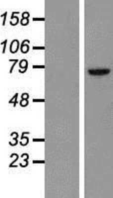 Western Blot: BTK Overexpression Lysate [NBP2-09059]