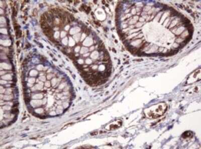 Immunohistochemistry: BTLA/CD272 Antibody (OTI2E4) [NBP2-45549]