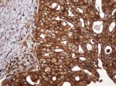 Immunohistochemistry: BTLA/CD272 Antibody (OTI2E4) [NBP2-45549]