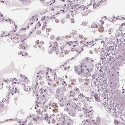 Immunohistochemistry-Paraffin: BTLA/CD272 Antibody [NBP2-49354]
