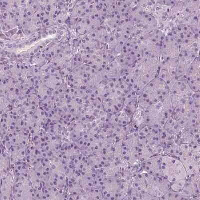 Immunohistochemistry-Paraffin: BTLA/CD272 Antibody [NBP2-49354]
