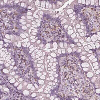 Immunohistochemistry-Paraffin: BTLA/CD272 Antibody [NBP2-49354]