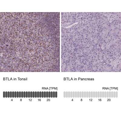 Immunohistochemistry-Paraffin: BTLA/CD272 Antibody [NBP2-49354]