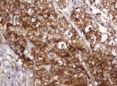 Immunohistochemistry: BTLA/CD272 Antibody (OTI2E4) - Azide and BSA Free [NBP2-72427]