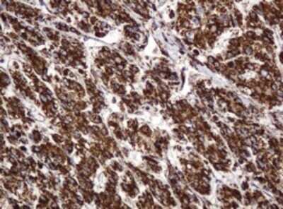 Immunohistochemistry: BTLA/CD272 Antibody (OTI2E4) - Azide and BSA Free [NBP2-72427]