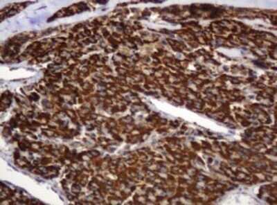 Immunohistochemistry: BTLA/CD272 Antibody (OTI2E4) - Azide and BSA Free [NBP2-72427]