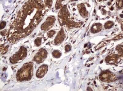 Immunohistochemistry: BTLA/CD272 Antibody (OTI2E4) - Azide and BSA Free [NBP2-72427]
