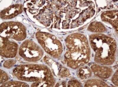 Immunohistochemistry: BTLA/CD272 Antibody (OTI2E4) - Azide and BSA Free [NBP2-72427]
