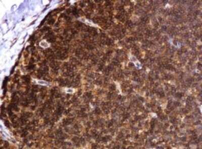 Immunohistochemistry: BTLA/CD272 Antibody (OTI2E4) - Azide and BSA Free [NBP2-72427]