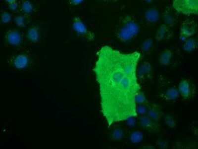 Immunocytochemistry/ Immunofluorescence: BTN1A1/Butyrophilin Antibody (OTI7B5) - Azide and BSA Free [NBP2-70299]