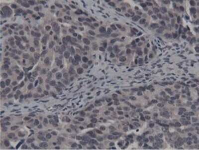 Immunohistochemistry: BTN1A1/Butyrophilin Antibody (OTI7B5) - Azide and BSA Free [NBP2-70299]