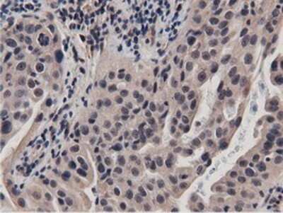 Immunohistochemistry: BTN1A1/Butyrophilin Antibody (OTI7B5) - Azide and BSA Free [NBP2-70299]
