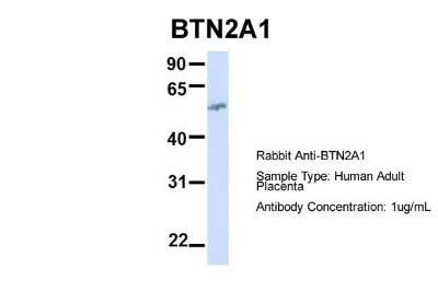 Western Blot: BTN2A1 Antibody [NBP1-62371]