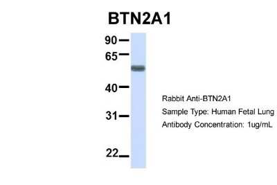 Western Blot: BTN2A1 Antibody [NBP1-62371]