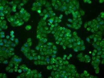 Immunocytochemistry/ Immunofluorescence: BTN3A2 Antibody (OTI1A6) - Azide and BSA Free [NBP2-71678]