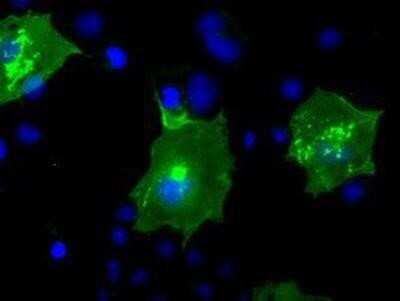 Immunocytochemistry/ Immunofluorescence: BTN3A2 Antibody (OTI1A6) - Azide and BSA Free [NBP2-71678]
