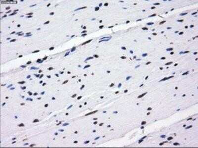 Immunohistochemistry: BTN3A2 Antibody (OTI1A6) - Azide and BSA Free [NBP2-71678]